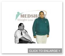 MedShape Weight Loss | Before and After
