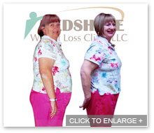 MedShape Weight Loss | Before and After
