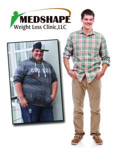 medshape before after