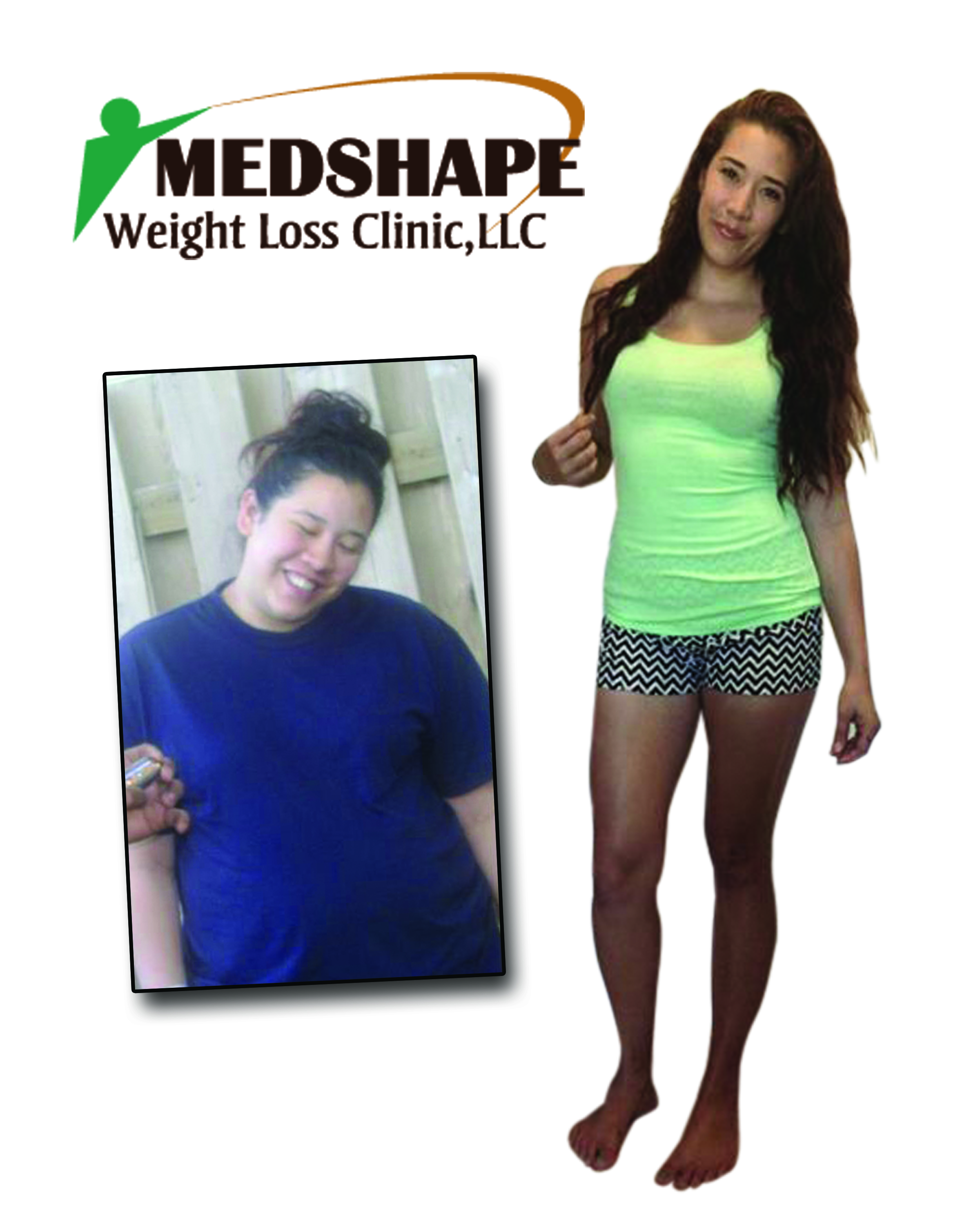 Medshape before / after Photo 4