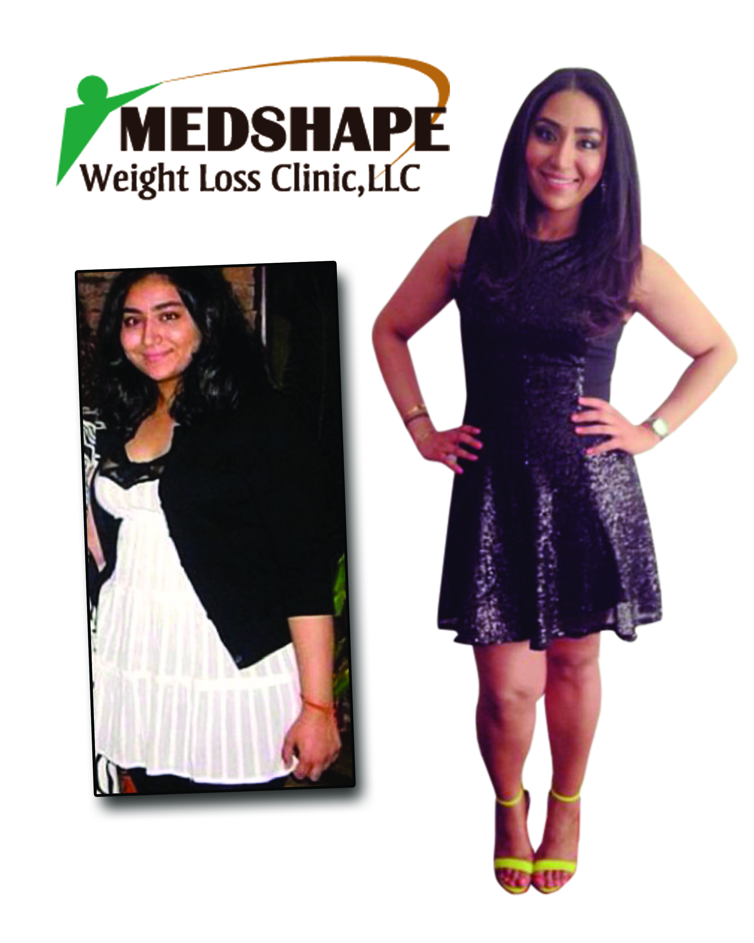 Medshape before / after Photo 3