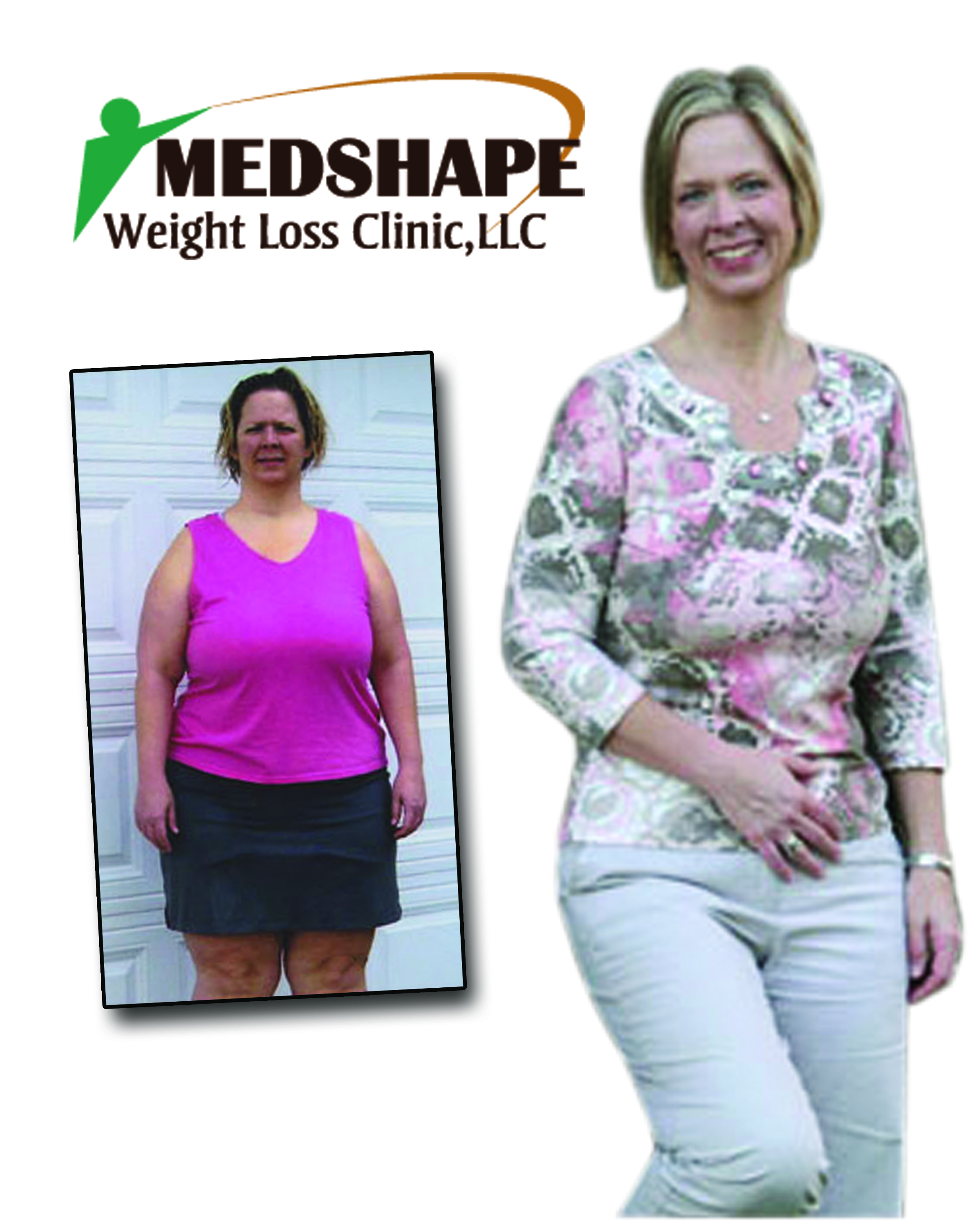 Medshape before / after Photo 6