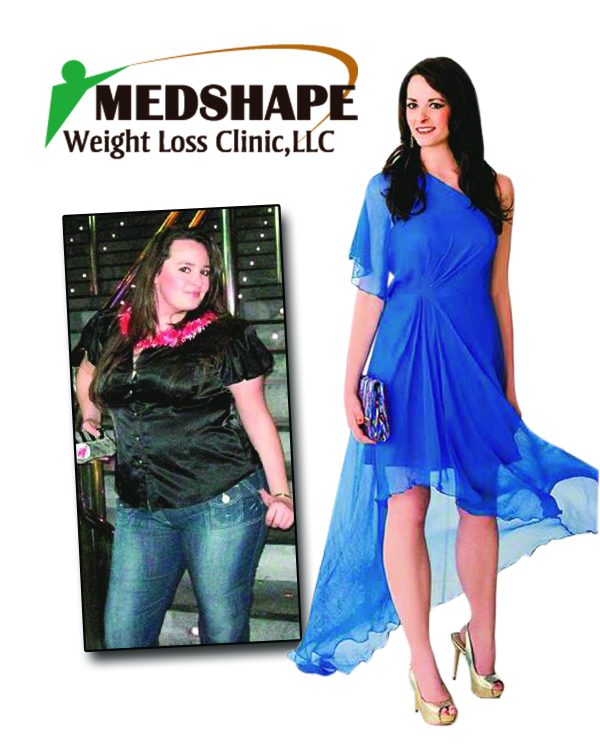 MedShape Weight Loss patient before and after her medical weight loss program