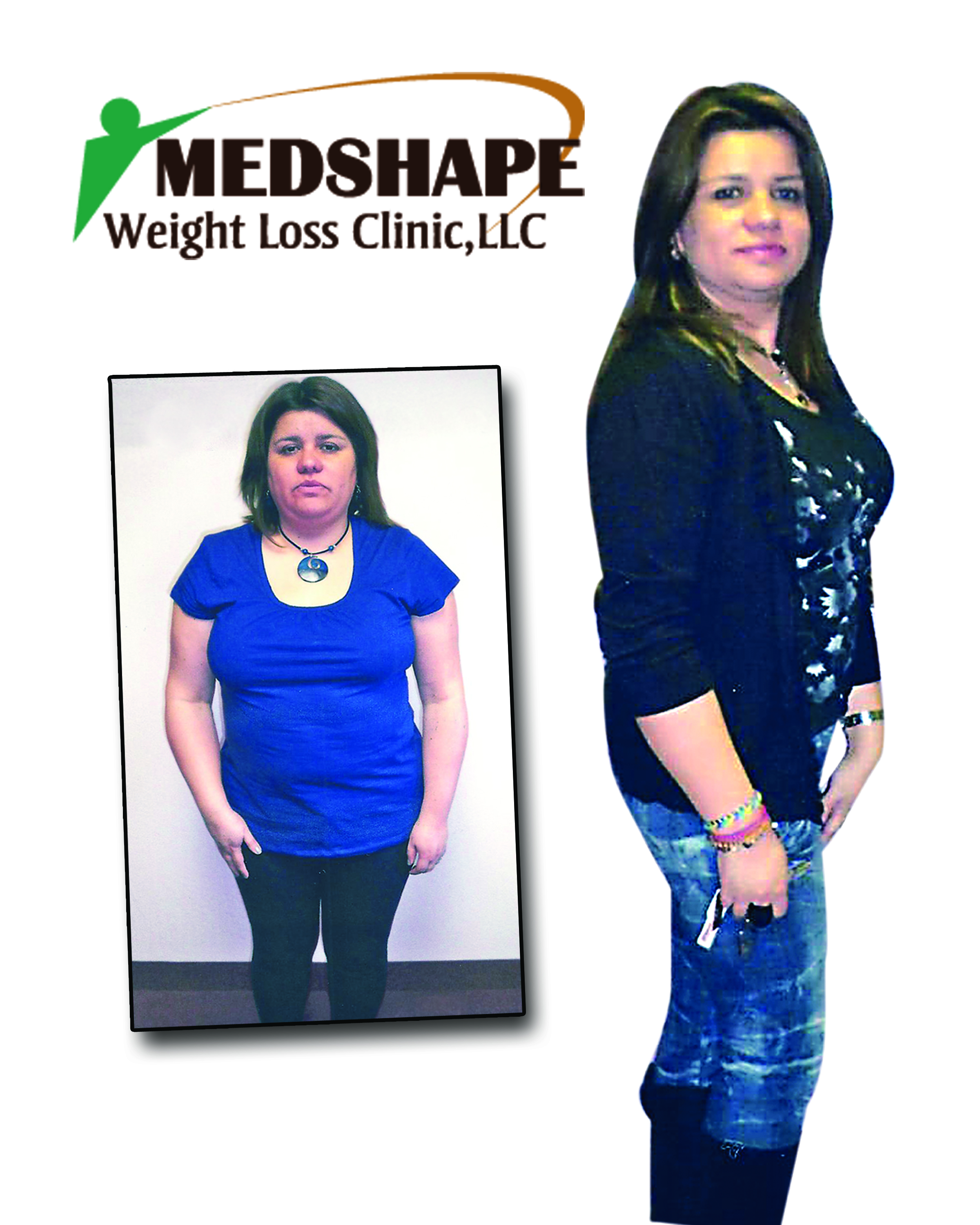 Medshape before / after Photo 7