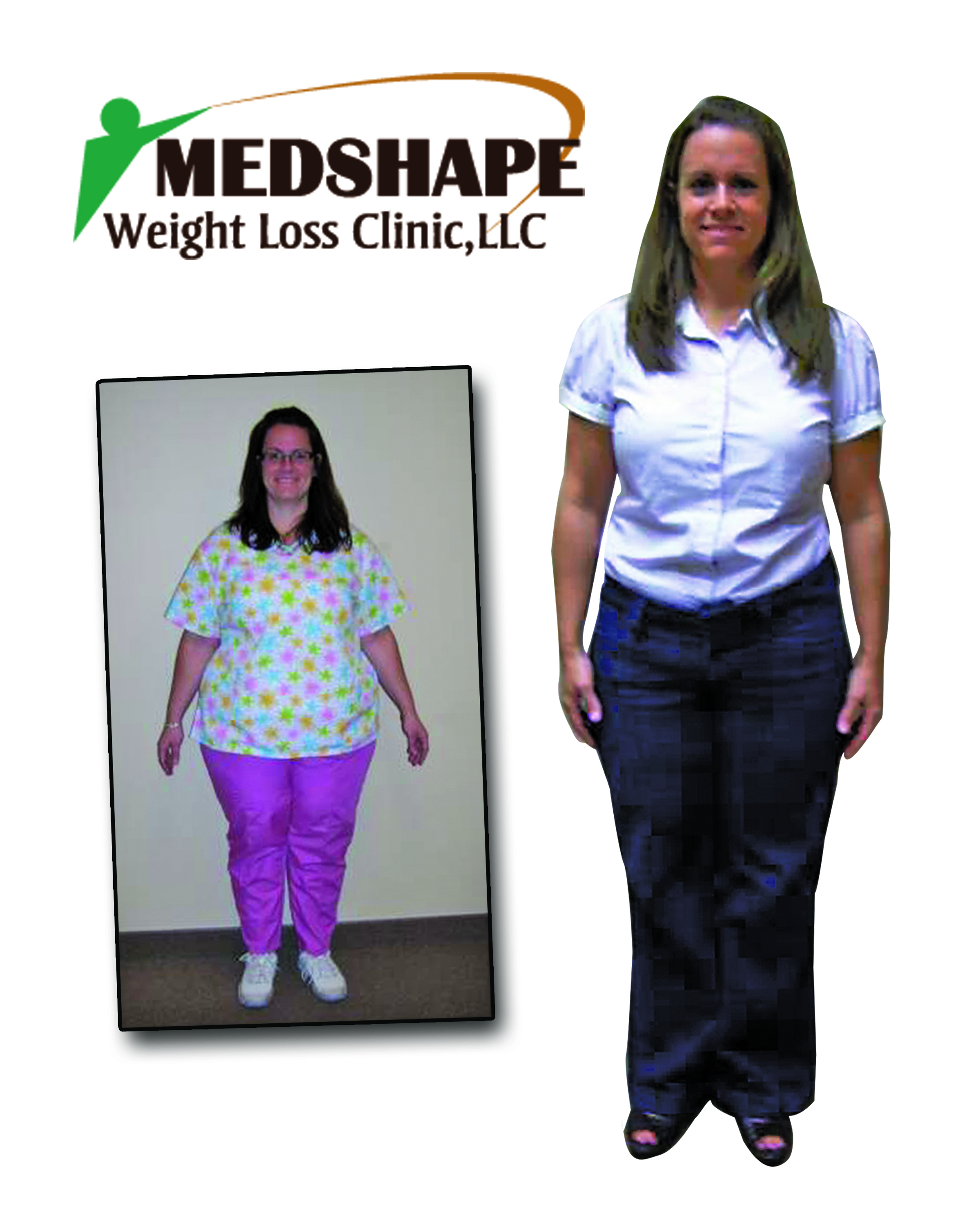 medshape before after weight loss 2