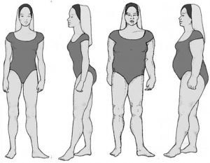 Your Body Type and Cellulite - Medshape Weight Loss Clinics