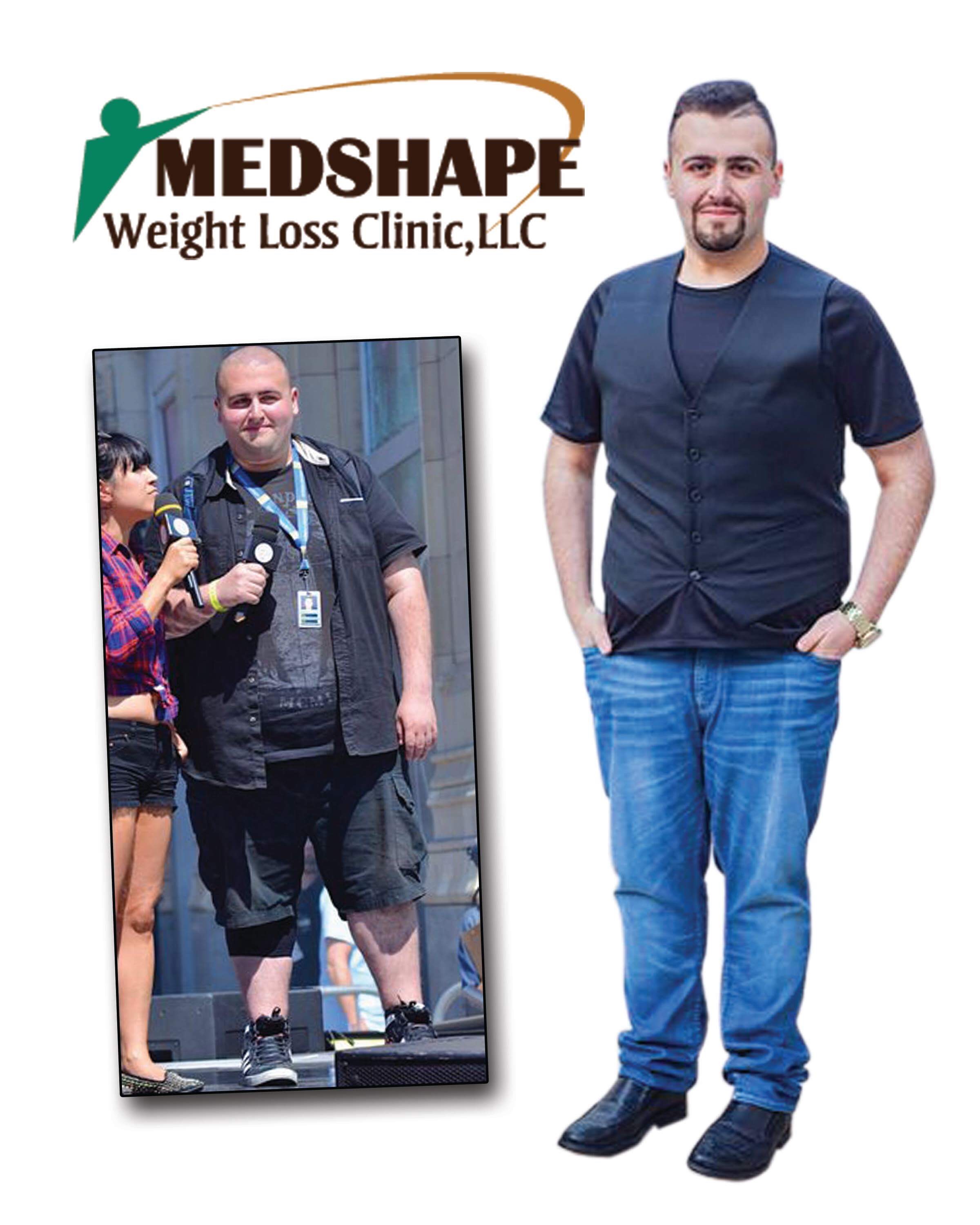 Medshape before / after Photo 9