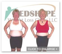 MedShape Weight Loss | Before and After