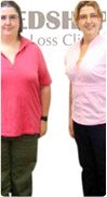 Weight Loss Clinics that work Before and After Weight Loss
